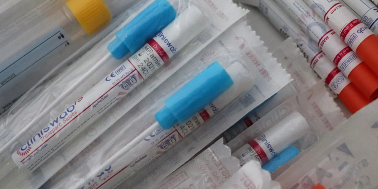 Koronawirus: Mimo, że w kolejnych krajach padać rekord zakażeń COVID-19 to jednak śmiertelność z tym związana nie rośnie jaka jest przyczyna?