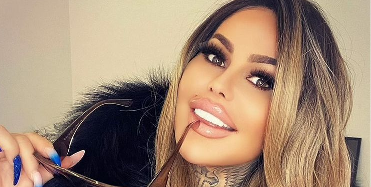 Laluna Unique z programu "Królowe Życia" przeszła kolejne operacje plastyczne, na Instagramie pokazała zdjęcia zrobione zaraz po zabiegu.