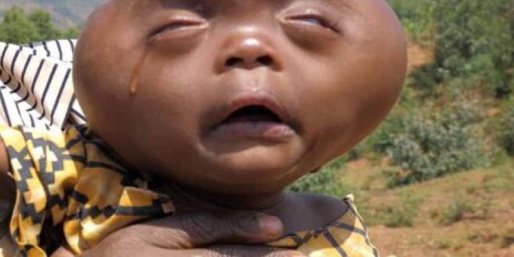 Dziecko „spłodzone przez diabła”, „kosmita”. Ojciec kazał je zabić, matka nie posłuchała…