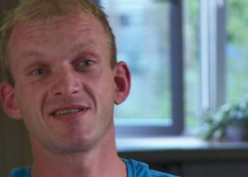 Szczena już tak nie wygląda, szokująca metamorfoza! Jest nie do poznania