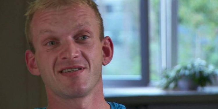 Szczena już tak nie wygląda, szokująca metamorfoza! Jest nie do poznania